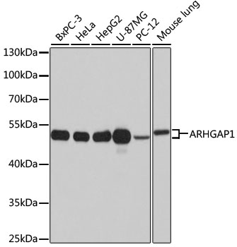 Western blot analysis of extracts of various cell lines, using ARHGAP1 antibody (TA373648) at 1:1000 dilution. - Secondary antibody: HRP Goat Anti-Rabbit IgG (H+L) at 1:10000 dilution. - Lysates/proteins: 25ug per lane. - Blocking buffer: 3% nonfat dry milk in TBST. - Detection: ECL Basic Kit . - Exposure time: 15s.