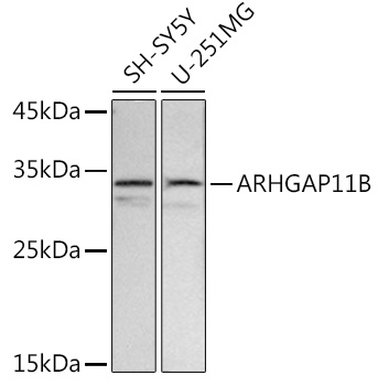 Western blot analysis of extracts of various cell lines, using ARHGAP11B antibody (TA373649) at 1:500 dilution. - Secondary antibody: HRP Goat Anti-Rabbit IgG (H+L) at 1:10000 dilution. - Lysates/proteins: 25ug per lane. - Blocking buffer: 3% nonfat dry milk in TBST. - Detection: ECL Basic Kit . - Exposure time: 2s.