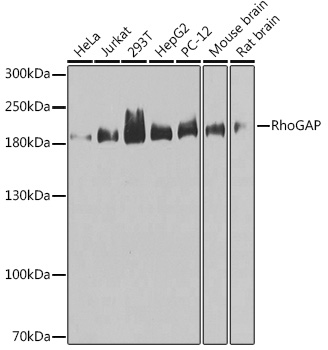 Western blot analysis of extracts of various cell lines, using RhoGAP antibody (TA373656) at 1:1000 dilution. - Secondary antibody: HRP Goat Anti-Rabbit IgG (H+L) at 1:10000 dilution. - Lysates/proteins: 25ug per lane. - Blocking buffer: 3% nonfat dry milk in TBST. - Detection: ECL Basic Kit . - Exposure time: 60s.