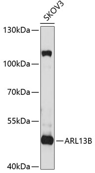 Western blot analysis of extracts of SKOV3 cells, using ARL13B antibody (TA373675) at 1:1000 dilution. - Secondary antibody: HRP Goat Anti-Rabbit IgG (H+L) at 1:10000 dilution. - Lysates/proteins: 25ug per lane. - Blocking buffer: 3% nonfat dry milk in TBST. - Detection: ECL Basic Kit . - Exposure time: 30s.