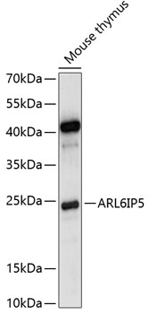 Western blot analysis of extracts of mouse thymus, using ARL6IP5 antibody (TA373685) at 1:1000 dilution. - Secondary antibody: HRP Goat Anti-Rabbit IgG (H+L) at 1:10000 dilution. - Lysates/proteins: 25ug per lane. - Blocking buffer: 3% nonfat dry milk in TBST. - Detection: ECL Basic Kit . - Exposure time: 5s.