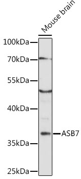 Western blot analysis of extracts of mouse brain, using ASB7 antibody (TA373725) at 1:1000 dilution. - Secondary antibody: HRP Goat Anti-Rabbit IgG (H+L) at 1:10000 dilution. - Lysates/proteins: 25ug per lane. - Blocking buffer: 3% nonfat dry milk in TBST. - Detection: ECL Enhanced Kit . - Exposure time: 30s.