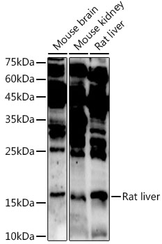 Western blot analysis of extracts of various cell lines, using ASCL4 antibody ( TA373730) at 1:1000 dilution. - Secondary antibody: HRP Goat Anti-Rabbit IgG (H+L) at 1:10000 dilution. - Lysates/proteins: 25ug per lane. - Blocking buffer: 3% nonfat dry milk in TBST. - Detection: ECL Enhanced Kit . - Exposure time: 180s.