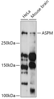 Western blot analysis of extracts of various cell lines, using ASPM antibody (TA373750) at 1:1000 dilution. - Secondary antibody: HRP Goat Anti-Rabbit IgG (H+L) at 1:10000 dilution. - Lysates/proteins: 25ug per lane. - Blocking buffer: 3% nonfat dry milk in TBST. - Detection: ECL Basic Kit . - Exposure time: 90s.