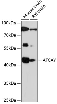 Western blot analysis of extracts of various cell lines, using ATCAY antibody (TA373760) at 1:1000 dilution. - Secondary antibody: HRP Goat Anti-Rabbit IgG (H+L) at 1:10000 dilution. - Lysates/proteins: 25ug per lane. - Blocking buffer: 3% nonfat dry milk in TBST. - Detection: ECL Basic Kit . - Exposure time: 90s.