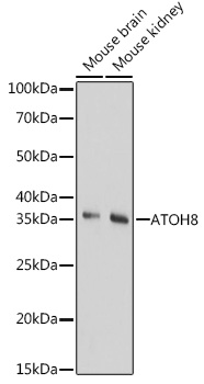 Western blot analysis of extracts of various cell lines, using ATOH8 Rabbit pAb (TA373795) at 1:1000 dilution. - Secondary antibody: HRP Goat Anti-Rabbit IgG (H+L) at 1:10000 dilution. - Lysates/proteins: 25ug per lane. - Blocking buffer: 3% nonfat dry milk in TBST. - Detection: ECL Basic Kit . - Exposure time: 180s.