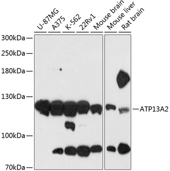 Western blot analysis of extracts of various cell lines, using ATP13A2 antibody (TA373802) at 1:3000 dilution. - Secondary antibody: HRP Goat Anti-Rabbit IgG (H+L) at 1:10000 dilution. - Lysates/proteins: 25ug per lane. - Blocking buffer: 3% nonfat dry milk in TBST. - Detection: ECL Basic Kit . - Exposure time: 30s.