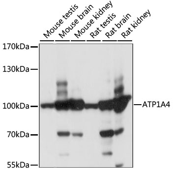 Western blot analysis of extracts of various cell lines, using ATP1A4 antibody (TA373808) at 1:1000 dilution. - Secondary antibody: HRP Goat Anti-Rabbit IgG (H+L) at 1:10000 dilution. - Lysates/proteins: 25ug per lane. - Blocking buffer: 3% nonfat dry milk in TBST. - Detection: ECL Basic Kit . - Exposure time: 1S.