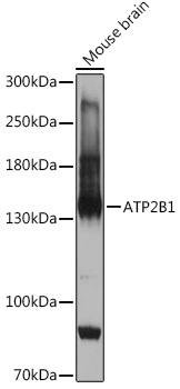 Western blot analysis of extracts of Mouse brain, using ATP2B1 antibody (TA373815) at 1:1000 dilution. - Secondary antibody: HRP Goat Anti-Rabbit IgG (H+L) at 1:10000 dilution. - Lysates/proteins: 25ug per lane. - Blocking buffer: 3% nonfat dry milk in TBST. - Detection: ECL Basic Kit . - Exposure time: 5s.