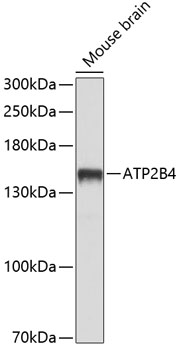Western blot analysis of extracts of mouse brain, using ATP2B4 antibody (TA373817) at 1:1000 dilution. - Secondary antibody: HRP Goat Anti-Rabbit IgG (H+L) at 1:10000 dilution. - Lysates/proteins: 25ug per lane. - Blocking buffer: 3% nonfat dry milk in TBST. - Detection: ECL Basic Kit . - Exposure time: 5s.