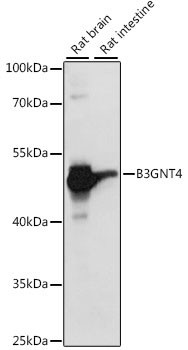 Western blot analysis of extracts of various cell lines, using B3GNT4 antibody (TA373894) at 1:1000 dilution. - Secondary antibody: HRP Goat Anti-Rabbit IgG (H+L) at 1:10000 dilution. - Lysates/proteins: 25ug per lane. - Blocking buffer: 3% nonfat dry milk in TBST. - Detection: ECL Basic Kit . - Exposure time: 5s.
