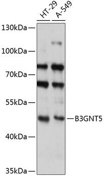 Western blot analysis of extracts of various cell lines, using B3GNT5 antibody (TA373895) at 1:3000 dilution. - Secondary antibody: HRP Goat Anti-Rabbit IgG (H+L) at 1:10000 dilution. - Lysates/proteins: 25ug per lane. - Blocking buffer: 3% nonfat dry milk in TBST. - Detection: ECL Basic Kit . - Exposure time: 30s.