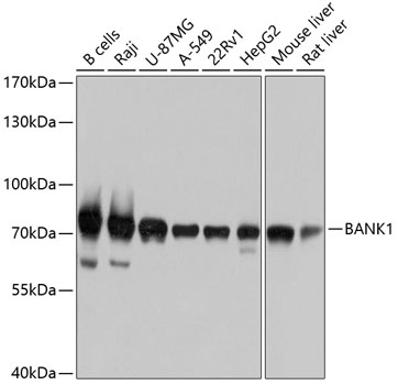 Western blot analysis of extracts of various cell lines, using BANK1 antibody (TA373926) at 1:1000 dilution. - Secondary antibody: HRP Goat Anti-Rabbit IgG (H+L) at 1:10000 dilution. - Lysates/proteins: 25ug per lane. - Blocking buffer: 3% nonfat dry milk in TBST. - Detection: ECL Basic Kit . - Exposure time: 3s.