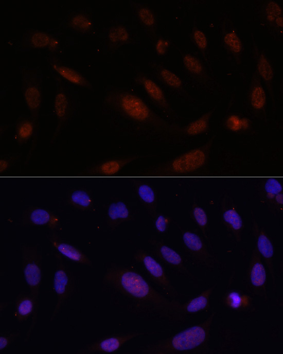 Immunofluorescence analysis of U2OS cells using Bcl9 Rabbit pAb (TA373975) at dilution of 100 (40x lens). Blue: DAPI for nuclear staining.
