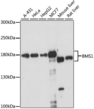 Western blot analysis of extracts of various cell lines, using BMS1 antibody (TA374040) at 1:1000 dilution. - Secondary antibody: HRP Goat Anti-Rabbit IgG (H+L) at 1:10000 dilution. - Lysates/proteins: 25ug per lane. - Blocking buffer: 3% nonfat dry milk in TBST. - Detection: ECL Enhanced Kit . - Exposure time: 15s.