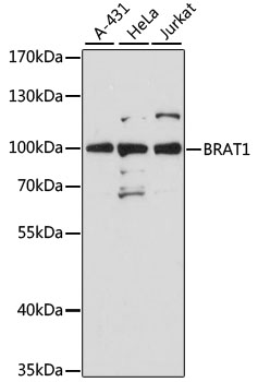 Western blot analysis of extracts of various cell lines, using Brat1 antibody (TA374061) at 1:3000 dilution. - Secondary antibody: HRP Goat Anti-Rabbit IgG (H+L) at 1:10000 dilution. - Lysates/proteins: 25ug per lane. - Blocking buffer: 3% nonfat dry milk in TBST. - Detection: ECL Basic Kit . - Exposure time: 30s.