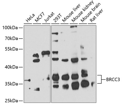 Western blot analysis of extracts of various cell lines, using BRCC3 antibody (TA374065) at 1:1000 dilution. - Secondary antibody: HRP Goat Anti-Rabbit IgG (H+L) at 1:10000 dilution. - Lysates/proteins: 25ug per lane. - Blocking buffer: 3% nonfat dry milk in TBST. - Detection: ECL Basic Kit . - Exposure time: 90s.