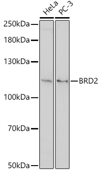 HEK293T cells were transfected with the pCMV6-ENTRY control (Left lane) or pCMV6-ENTRY ERBB3 (RC209954, Right lane) cDNA for 48 hrs and lysed. Equivalent amounts of cell lysates (5 ug per lane) were separated by SDS-PAGE and immunoblotted with anti-ERBB3. Positive lysates LY400725 (100 ug) and LC400725 (20 ug) can be purchased separately from OriGene.