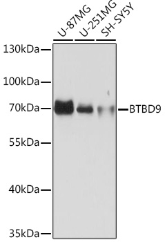 Western blot analysis of extracts of various cell lines, using BTBD9 Rabbit pAb (TA374102) at 1:1000 dilution. - Secondary antibody: HRP Goat Anti-Rabbit IgG (H+L) at 1:10000 dilution. - Lysates/proteins: 25ug per lane. - Blocking buffer: 3% nonfat dry milk in TBST. - Detection: ECL Basic Kit . - Exposure time: 5s.