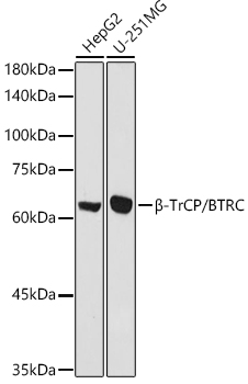 Western blot analysis of extracts of various cell lines, using beta-TrCP/BTRC antibody (TA374113) at 1:1000 dilution. - Secondary antibody: HRP Goat Anti-Rabbit IgG (H+L) at 1:10000 dilution. - Lysates/proteins: 25ug per lane. - Blocking buffer: 3% nonfat dry milk in TBST. - Detection: ECL Basic Kit . - Exposure time: 30s.