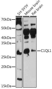 Western blot analysis of extracts of various cell lines, using C1QL1 antibody (TA374138) at 1:1000 dilution. - Secondary antibody: HRP Goat Anti-Rabbit IgG (H+L) at 1:10000 dilution. - Lysates/proteins: 25ug per lane. - Blocking buffer: 3% nonfat dry milk in TBST. - Detection: ECL Basic Kit . - Exposure time: 10s.