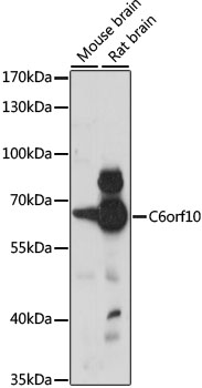 Western blot analysis of extracts of various cell lines, using C6orf10 antibody (TA374161) at 1:1000 dilution. - Secondary antibody: HRP Goat Anti-Rabbit IgG (H+L) at 1:10000 dilution. - Lysates/proteins: 25ug per lane. - Blocking buffer: 3% nonfat dry milk in TBST. - Detection: ECL Basic Kit . - Exposure time: 30s.