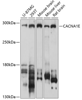 Western blot analysis of extracts of various cell lines, using CACNA1E antibody (TA374187) at 1:1000 dilution. - Secondary antibody: HRP Goat Anti-Rabbit IgG (H+L) at 1:10000 dilution. - Lysates/proteins: 25ug per lane. - Blocking buffer: 3% nonfat dry milk in TBST. - Detection: ECL Basic Kit . - Exposure time: 30s.