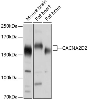 Western blot analysis of extracts of various cell lines, using CACNA2D2 antibody (TA374190) at 1:1000 dilution. - Secondary antibody: HRP Goat Anti-Rabbit IgG (H+L) at 1:10000 dilution. - Lysates/proteins: 25ug per lane. - Blocking buffer: 3% nonfat dry milk in TBST. - Detection: ECL Enhanced Kit . - Exposure time: 1s.