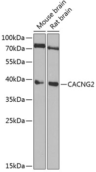 Human recombinant protein fragment corresponding to amino acids 1787-2144 of human SETD2 (NP_054878) produced in E.coli (1:500).