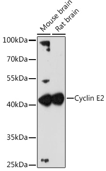 Western blot analysis of extracts of various cell lines, using Cyclin E2 antibody (TA374385) at 1:3000 dilution. - Secondary antibody: HRP Goat Anti-Rabbit IgG (H+L) at 1:10000 dilution. - Lysates/proteins: 25ug per lane. - Blocking buffer: 3% nonfat dry milk in TBST. - Detection: ECL Enhanced Kit . - Exposure time: 90s.