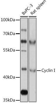 Western blot analysis of extracts of various cell lines, using Cyclin I antibody (TA374388) at 1:1000 dilution. - Secondary antibody: HRP Goat Anti-Rabbit IgG (H+L) at 1:10000 dilution. - Lysates/proteins: 25ug per lane. - Blocking buffer: 3% nonfat dry milk in TBST. - Detection: ECL Basic Kit . - Exposure time: 10s.