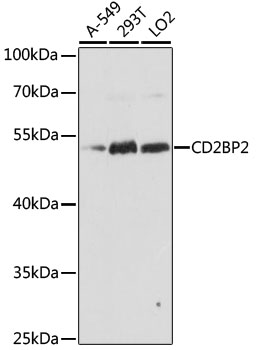 Western blot analysis of extracts of various cell lines, using CD2BP2 antibody (TA374435) at 1:1000 dilution. - Secondary antibody: HRP Goat Anti-Rabbit IgG (H+L) at 1:10000 dilution. - Lysates/proteins: 25ug per lane. - Blocking buffer: 3% nonfat dry milk in TBST. - Detection: ECL Basic Kit . - Exposure time: 60s.