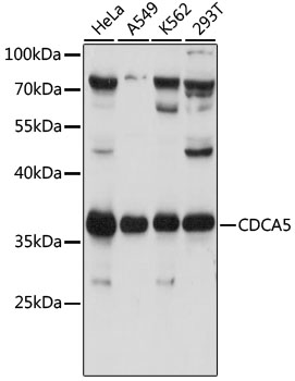 Western blot analysis of extracts of various cell lines, using CDCA5 antibody (TA374511) at 1:1000 dilution. - Secondary antibody: HRP Goat Anti-Rabbit IgG (H+L) at 1:10000 dilution. - Lysates/proteins: 25ug per lane. - Blocking buffer: 3% nonfat dry milk in TBST. - Detection: ECL Basic Kit . - Exposure time: 1s.