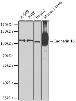 Western blot analysis of extracts of various cell lines, using Cadherin 16 antibody (TA374529) at 1:1000 dilution. - Secondary antibody: HRP Goat Anti-Rabbit IgG (H+L) at 1:10000 dilution. - Lysates/proteins: 25ug per lane. - Blocking buffer: 3% nonfat dry milk in TBST. - Detection: ECL Basic Kit . - Exposure time: 90s.