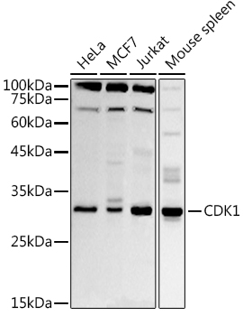 HEK293T cells were transfected with the pCMV6-ENTRY control (Cat# PS100001, Left lane) or pCMV6-ENTRY ECE1 (Cat# RC223135, Right lane) cDNA for 48 hrs and lysed. Equivalent amounts of cell lysates (5 ug per lane) were separated by SDS-PAGE and immunoblotted with anti-ECE1(Cat# TA804823). Positive lysates [LY419958] (100 ug) and [LC419958] (20 ug) can be purchased separately from OriGene.
