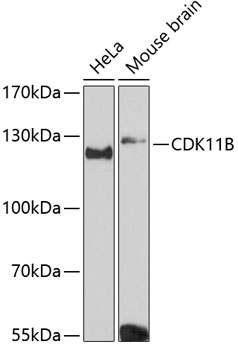 Western blot analysis of extracts of various cell lines, using CDK11B Antibody (TA374549) at 1:3000 dilution. - Secondary antibody: HRP Goat Anti-Rabbit IgG (H+L) at 1:10000 dilution. - Lysates/proteins: 25ug per lane. - Blocking buffer: 3% nonfat dry milk in TBST. - Detection: ECL Basic Kit . - Exposure time: 90s.