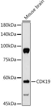 Western blot analysis of extracts of Mouse brain, using CDK19 antibody (TA374556) at 1:500 dilution. - Secondary antibody: HRP Goat Anti-Rabbit IgG (H+L) at 1:10000 dilution. - Lysates/proteins: 25ug per lane. - Blocking buffer: 3% nonfat dry milk in TBST. - Detection: ECL Basic Kit . - Exposure time: 30s.