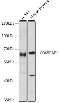 Western blot analysis of extracts of various cell lines, using CDK5RAP1 antibody (TA374566) at 1:1000 dilution. - Secondary antibody: HRP Goat Anti-Rabbit IgG (H+L) at 1:10000 dilution. - Lysates/proteins: 25ug per lane. - Blocking buffer: 3% nonfat dry milk in TBST. - Detection: ECL Enhanced Kit . - Exposure time: 30s.