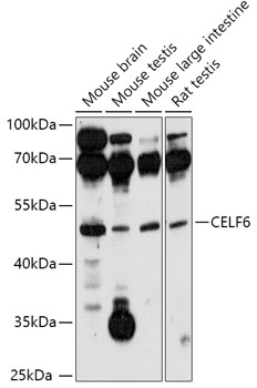 Western blot analysis of extracts of various cell lines, using CELF6 antibody (TA374628) at 1:1000 dilution. - Secondary antibody: HRP Goat Anti-Rabbit IgG (H+L) at 1:10000 dilution. - Lysates/proteins: 25ug per lane. - Blocking buffer: 3% nonfat dry milk in TBST. - Detection: ECL Basic Kit . - Exposure time: 3min.