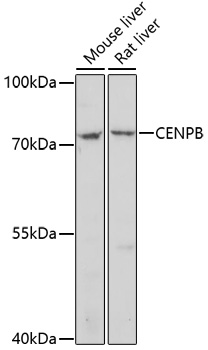Western blot analysis of extracts of various cell lines, using CENPB antibody (TA374633) at 1:1000 dilution. - Secondary antibody: HRP Goat Anti-Rabbit IgG (H+L) at 1:10000 dilution. - Lysates/proteins: 25ug per lane. - Blocking buffer: 3% nonfat dry milk in TBST. - Detection: ECL Basic Kit . - Exposure time: 5min.