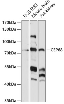 Western blot analysis of extracts of various cell lines, using CEP68 antibody (TA374653) at 1:1000 dilution. - Secondary antibody: HRP Goat Anti-Rabbit IgG (H+L) at 1:10000 dilution. - Lysates/proteins: 25ug per lane. - Blocking buffer: 3% nonfat dry milk in TBST. - Detection: ECL Enhanced Kit . - Exposure time: 90s.