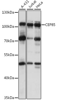 Western blot analysis of extracts of various cell lines, using CEP85 antibody (TA374656) at 1:1000 dilution. - Secondary antibody: HRP Goat Anti-Rabbit IgG (H+L) at 1:10000 dilution. - Lysates/proteins: 25ug per lane. - Blocking buffer: 3% nonfat dry milk in TBST. - Detection: ECL Basic Kit . - Exposure time: 10s.