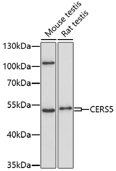 Western blot analysis of extracts of various cell lines, using CERS5 antibody (TA374662) at 1:1000 dilution. - Secondary antibody: HRP Goat Anti-Rabbit IgG (H+L) at 1:10000 dilution. - Lysates/proteins: 25ug per lane. - Blocking buffer: 3% nonfat dry milk in TBST. - Detection: ECL Basic Kit . - Exposure time: 90s.