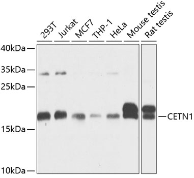 Western blot analysis of extracts of various cell lines, using CETN1 antibody (TA374666) at 1:1000 dilution. - Secondary antibody: HRP Goat Anti-Rabbit IgG (H+L) at 1:10000 dilution. - Lysates/proteins: 25ug per lane. - Blocking buffer: 3% nonfat dry milk in TBST. - Detection: ECL Basic Kit . - Exposure time: 10s.