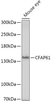 Western blot analysis of extracts of Mouse eye, using CFAP61 antibody (TA374671) at 1:1000 dilution. - Secondary antibody: HRP Goat Anti-Rabbit IgG (H+L) at 1:10000 dilution. - Lysates/proteins: 25ug per lane. - Blocking buffer: 3% nonfat dry milk in TBST. - Detection: ECL Basic Kit . - Exposure time: 3min.
