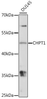 Western blot analysis of extracts of DU145 cells, using CHPT1 antibody (TA374759) at 1:1000 dilution. - Secondary antibody: HRP Goat Anti-Rabbit IgG (H+L) at 1:10000 dilution. - Lysates/proteins: 25ug per lane. - Blocking buffer: 3% nonfat dry milk in TBST. - Detection: ECL Basic Kit . - Exposure time: 30s.
