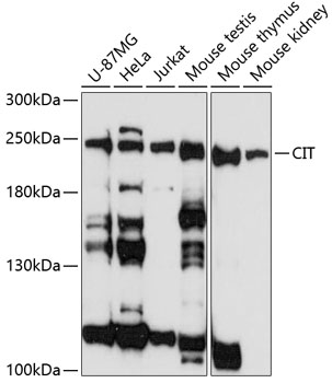 Western blot analysis of extracts of various cell lines, using CIT antibody (TA374816) at 1:3000 dilution. - Secondary antibody: HRP Goat Anti-Rabbit IgG (H+L) at 1:10000 dilution. - Lysates/proteins: 25ug per lane. - Blocking buffer: 3% nonfat dry milk in TBST. - Detection: ECL Basic Kit . - Exposure time: 90s.