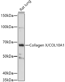 Western blot analysis of extracts of Rat lung, using Collagen X/COL10A1 antibody (TA374955) at 1:1000 dilution. - Secondary antibody: HRP Goat Anti-Rabbit IgG (H+L) at 1:10000 dilution. - Lysates/proteins: 25ug per lane. - Blocking buffer: 3% nonfat dry milk in TBST. - Detection: ECL Basic Kit . - Exposure time: 180s.