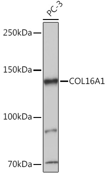 Western blot analysis of extracts of PC-3 cells, using COL16A1 antibody (TA374957) at 1:1000 dilution. - Secondary antibody: HRP Goat Anti-Rabbit IgG (H+L) at 1:10000 dilution. - Lysates/proteins: 25ug per lane. - Blocking buffer: 3% nonfat dry milk in TBST. - Detection: ECL Basic Kit . - Exposure time: 1s.