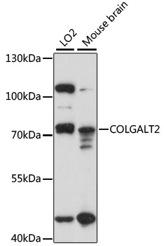 Western blot analysis of extracts of various cell lines, using COLGALT2 antibody (TA374978) at 1:1000 dilution. - Secondary antibody: HRP Goat Anti-Rabbit IgG (H+L) at 1:10000 dilution. - Lysates/proteins: 25ug per lane. - Blocking buffer: 3% nonfat dry milk in TBST. - Detection: ECL Basic Kit . - Exposure time: 30s.